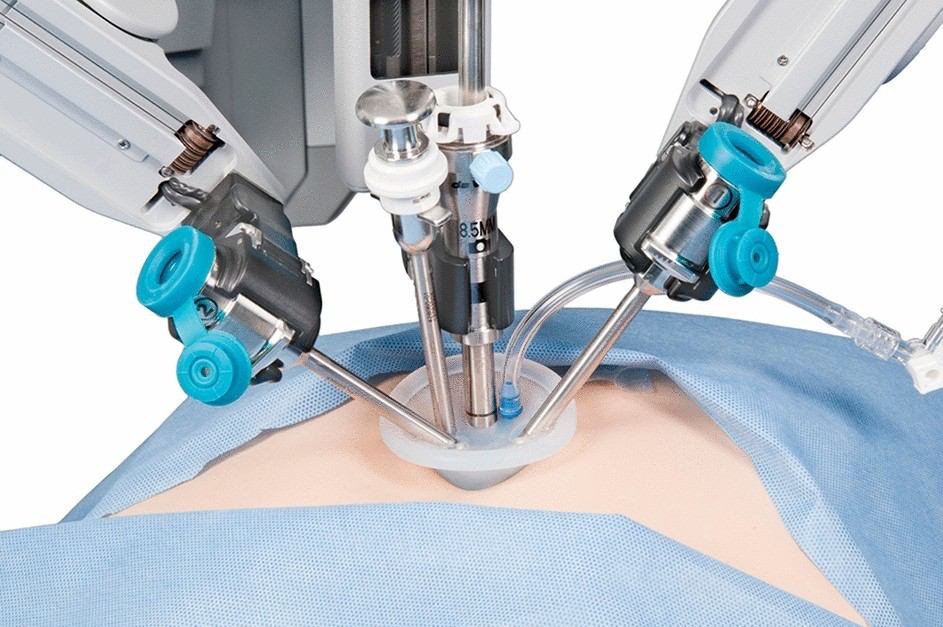 Robotic GI Cancer Surgery